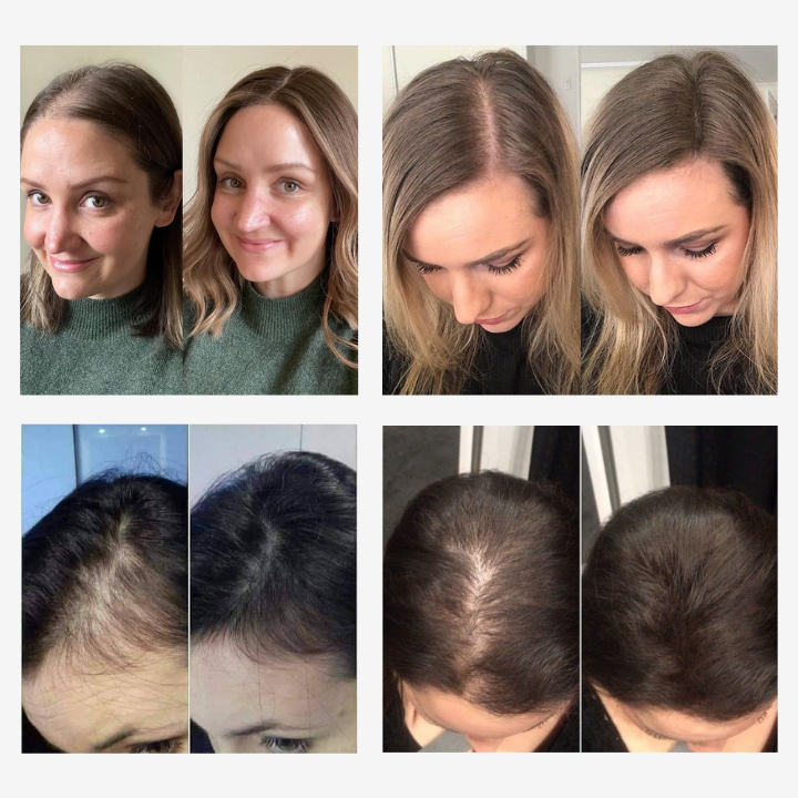 Sérum VÉRA™ - Zastavuje vypadávání vlasů a obnovuje jejich hustotu